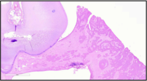 microscopic view of oral tumor in dog