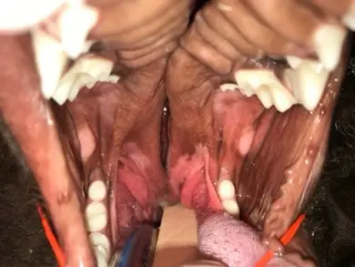 pet oral surgery Milwaukee; Figure 2: Extension of the cleft into the soft palate