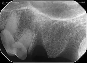 CT image of dog broken tooth after extraction