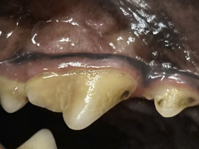 Discolored teeth due to calculus (tartar) accumulation.